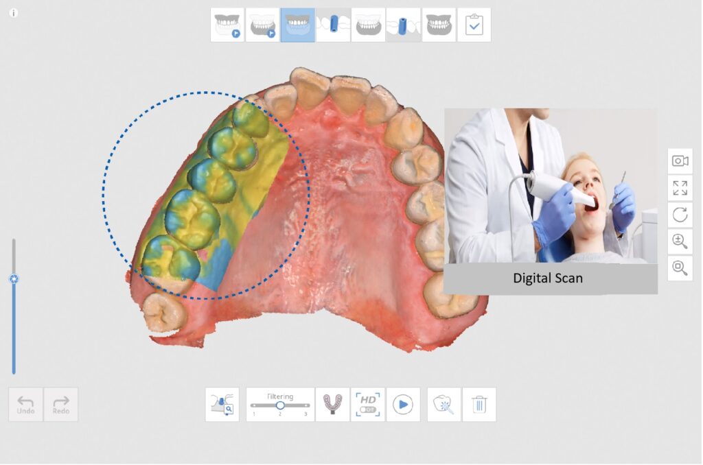 Figure 2. Scanning of a patient’s teeth for 3D model creation