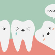The Top 5 Questions About Wisdom Teeth Removal [video]