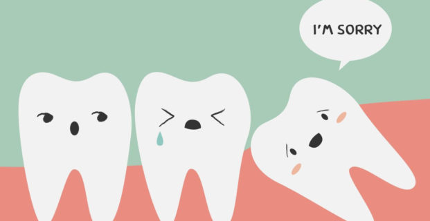 The Top 5 Questions About Wisdom Teeth Removal [video]